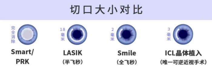 Tigerless虎虎保险_近视眼手术.jpg